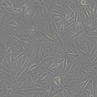 Saos2人成骨肉瘤细胞(带STR鉴定)