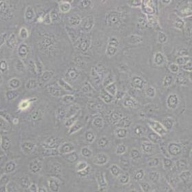 NCI-H1650人非小细胞肺癌细胞(带STR鉴定)