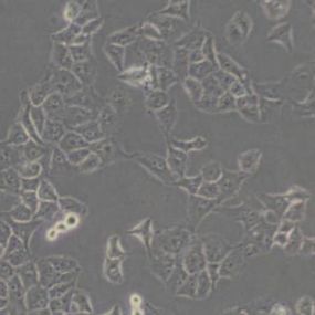 PANC1人胰腺癌细胞(带STR鉴定)