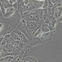 MCF7人乳腺癌细胞(带STR鉴定)