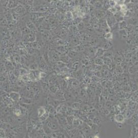 JAR人胎盘绒毛癌细胞(带STR鉴定)