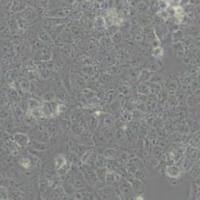 JAR人胎盘绒毛癌细胞(带STR鉴定)