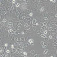 OVCAR3人卵巢癌细胞(带STR鉴定)