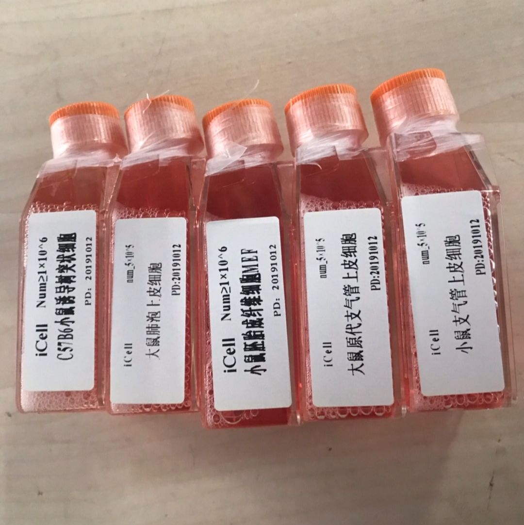 SW620+GFP、SW620细胞、SW620/GFP细胞、SW620/GFP、结直肠腺癌细胞+GFP/免疫荧光鉴定/镜像绮点(Cellverse)