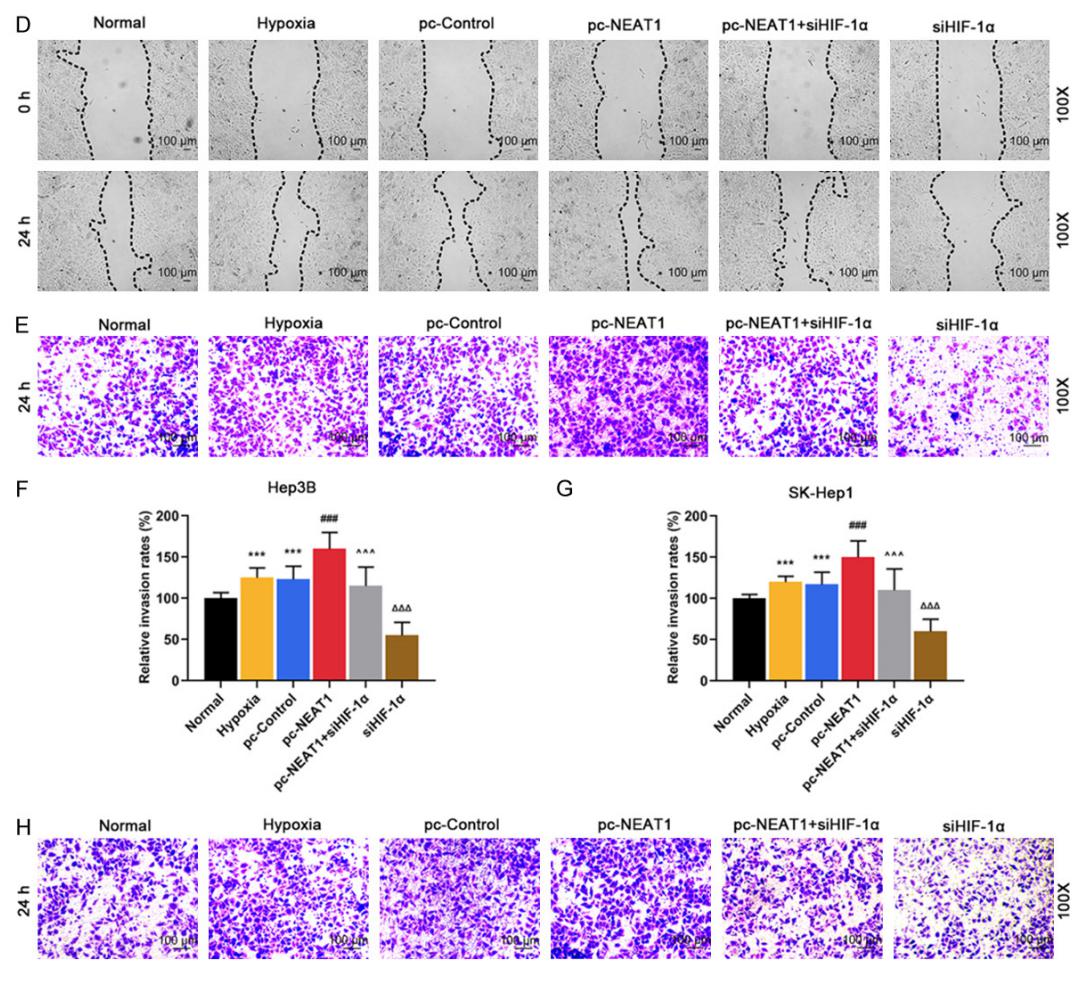 低氧/厌氧产品案例——低氧与肝癌研究
