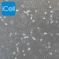 GBC-SD+luc 人胆囊癌细胞+luc 免疫荧光鉴定 镜像绮点(Cellverse)