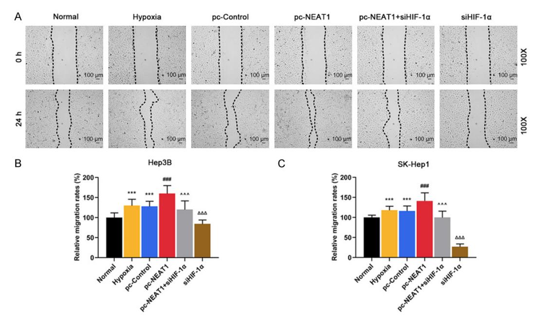 低氧/厌氧产品案例——低氧与肝癌研究