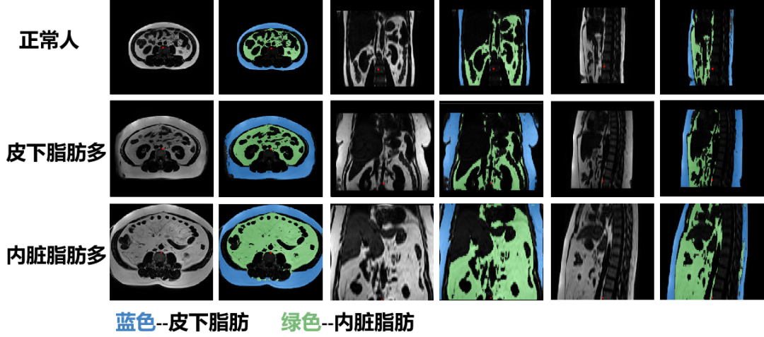上海全景医学影像诊断中心：关注女性子宫内膜癌