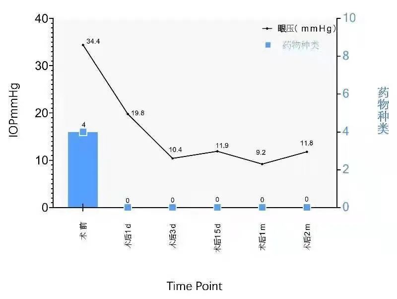 61 岁杭州阿姨，眼痛到想摘除眼球，被医生劝住了