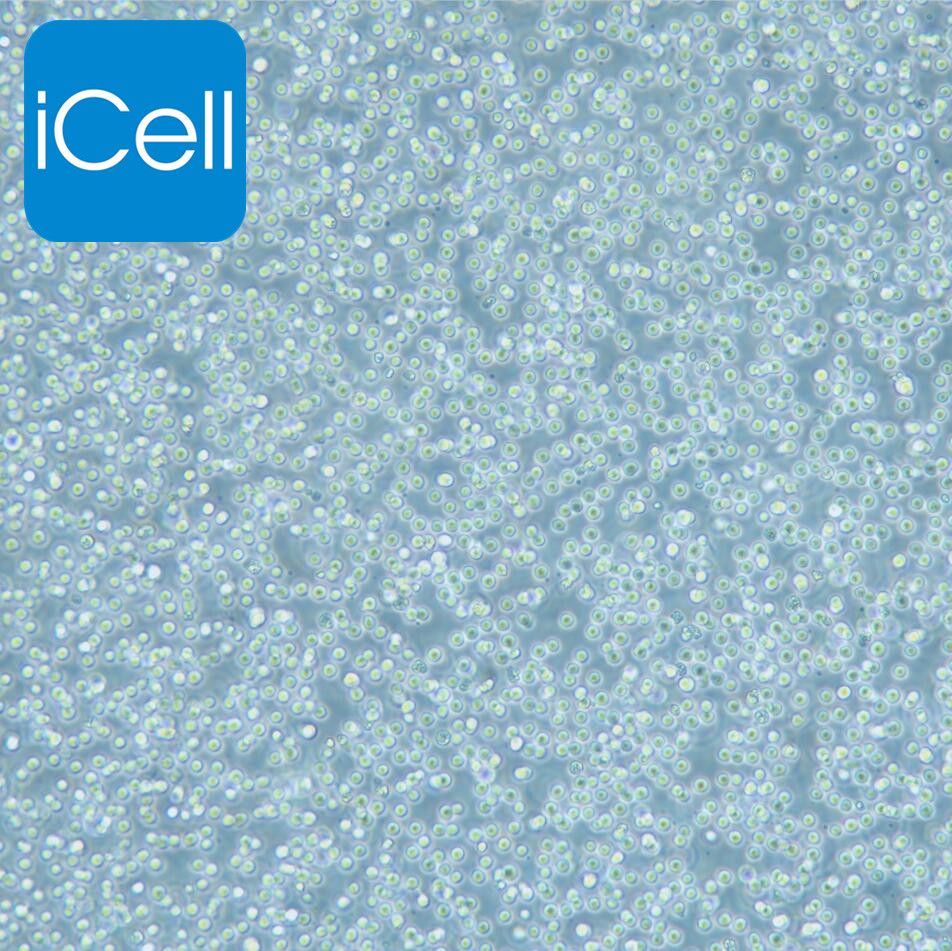 SU-DHL-4 人B淋巴瘤细胞/STR鉴定/镜像绮点（Cellverse）