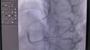 23 分钟急救心梗患者,深圳市萨米医疗中心是怎么做到的?