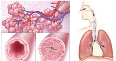 哮喘病因与日常预防护理指南