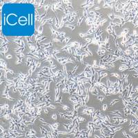 TT/TT细胞/人甲状腺癌细胞/STR鉴定/镜像绮点（Cellverse）