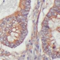 兔多克隆 AGXT2L2 抗体丨anti- AGXT2L2 antibody