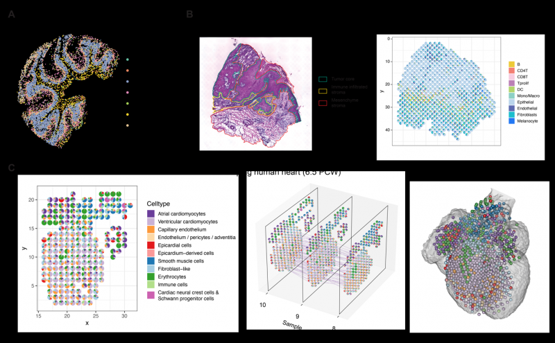 同济大学附属同济医院王晨飞课题组开发空间转录组分析算法 STRIDE
