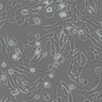 SKNSH人神经母细胞瘤细胞(带STR鉴定)