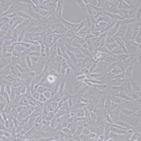U2OS人骨肉瘤细胞(带STR鉴定)