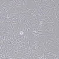 U2OS人骨肉瘤细胞(带STR鉴定)