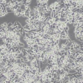 CW2人结肠腺癌细胞(带STR鉴定)