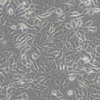 SKHep1人肝癌细胞(带STR鉴定)