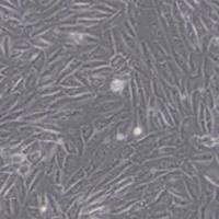 EA.hy926人脐静脉细胞融合细胞(带STR鉴定)