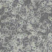 SKBR3人乳腺腺癌细胞（带STR鉴定）