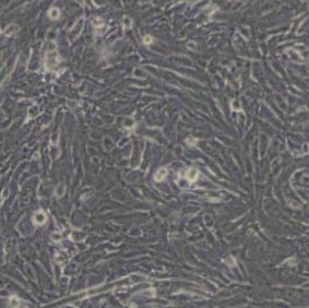 U251人胶质瘤细胞(带STR鉴定)