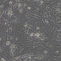 U251人胶质瘤细胞(带STR鉴定)