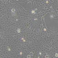 CAL27人舌鳞癌细胞(带STR鉴定)