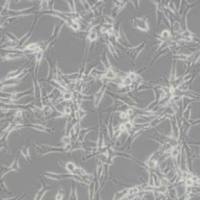 U87MG人脑星形胶质母细胞瘤细胞（带STR鉴定）