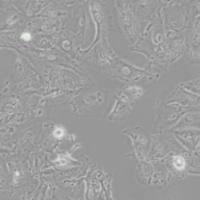 A875人黑色素瘤细胞(带STR鉴定)