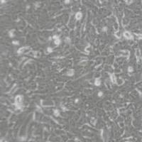 SKMES1人肺鳞癌细胞(带STR鉴定)