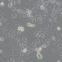 TE1人食管癌细胞(带STR鉴定)