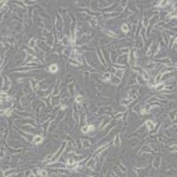 C918人眼脉络黑色素瘤细胞(带STR鉴定)