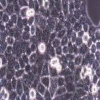 SPCA1人肺腺癌细胞(带STR鉴定)