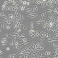 SKOV3人卵巢癌细胞(带STR鉴定)