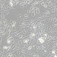 MDA-MB-415人乳腺癌细胞(带STR鉴定)