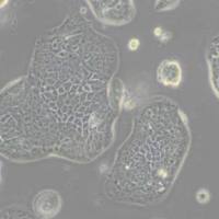 SW1116人结肠腺癌细胞(带STR鉴定)