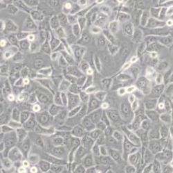 HCC94[HCC941122]人子宫鳞癌细胞(高分化)(带STR鉴定)