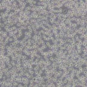 Jurkat clone A3人T淋巴细胞白血病细胞(带STR鉴定)