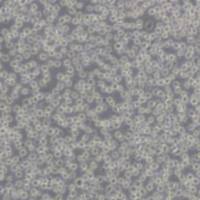 Jurkat clone A3人T淋巴细胞白血病细胞(带STR鉴定)