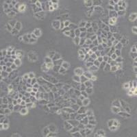 NCI-H460人大细胞肺癌细胞(带STR鉴定)