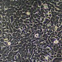 HCCLM3人高转移肝癌细胞（带STR鉴定）