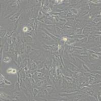 hFOB1.19 人SV40转染成骨细胞(带STR鉴定)