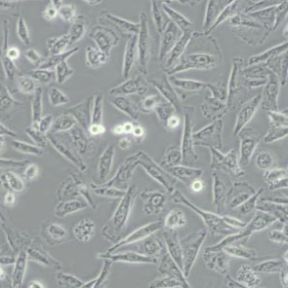 NCI-H1975人肺腺癌细胞(带STR鉴定)