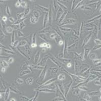 NCI-H1975人肺腺癌细胞(带STR鉴定)