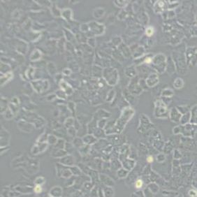 Ishikawa人子宫内膜癌细胞(带STR鉴定)