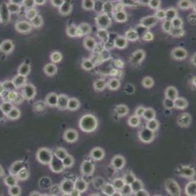 HEL人红白细胞白血病细胞(带STR鉴定)