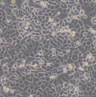 MDA-MB-468人乳腺癌细胞(带STR鉴定)