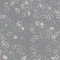 PC3M人前列腺癌细胞(带STR鉴定正确)